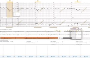 PeriGen's Cues offers cutting-edge L&D strip analysis