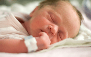 obstetric malpractice