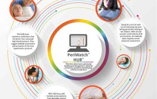 PeriWatch HUB Team Stories