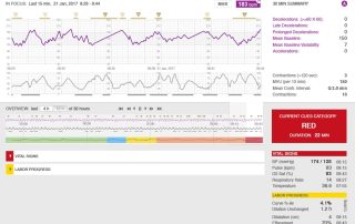 Perinatal Early Warning System